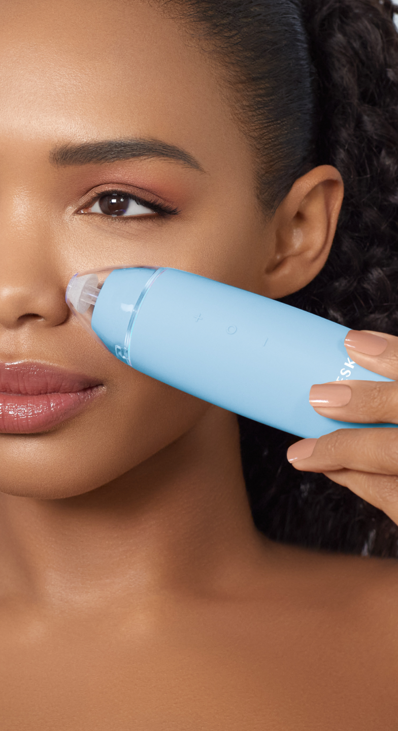 MicroDermabrasion Blackhead Remover | 7 in 1